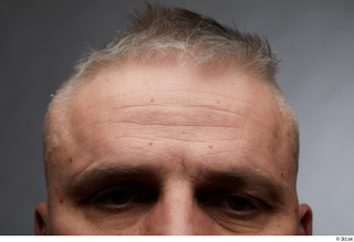  HD Face Skin Yury eyebrow face forehead skin pores skin texture wrinkles 0001.jpg